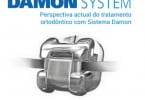 Damon System Ormco