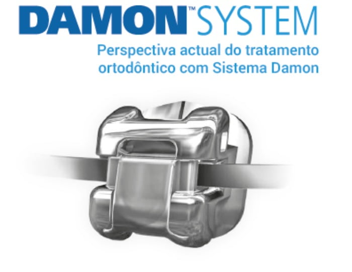 Damon System Ormco