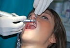 doença periodontal Saúde Oral
