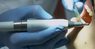 check up dentário Saúde Oral