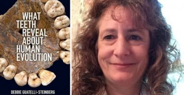 debbie steinberg Saúde Oral