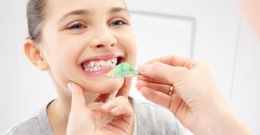 oclusão assimétrica pode ser causada pelo stress