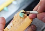 próteses dentárias Saúde Oral