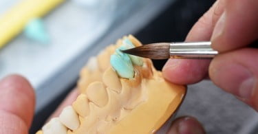 próteses dentárias Saúde Oral