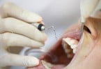 periodontite tratamento Saúde Oral