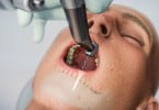 Empresa norte-americana cria robot para colocação de implantes