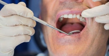 Será que os pacientes sabem reconhecer sintomas de cancro oral?