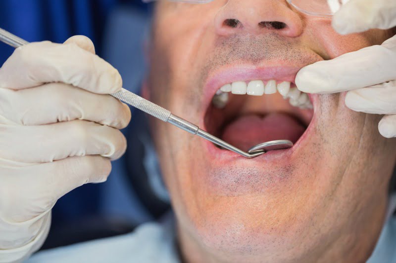 Será que os pacientes sabem reconhecer sintomas de cancro oral?