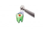 Dentaleader lança acoplamento Fluoresce HD