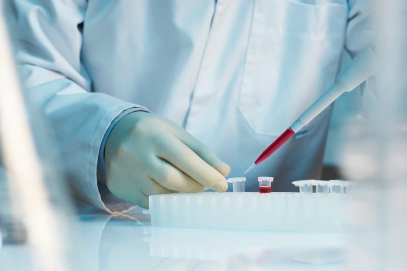 Dentistas conseguem extrair células estaminais de terceiro molar