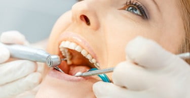 Restaurações dentárias podem ter os dias contados