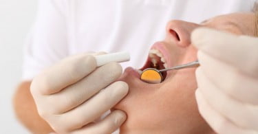 Abordagem multidisciplinar pode reduzir incidência de cáries dentárias