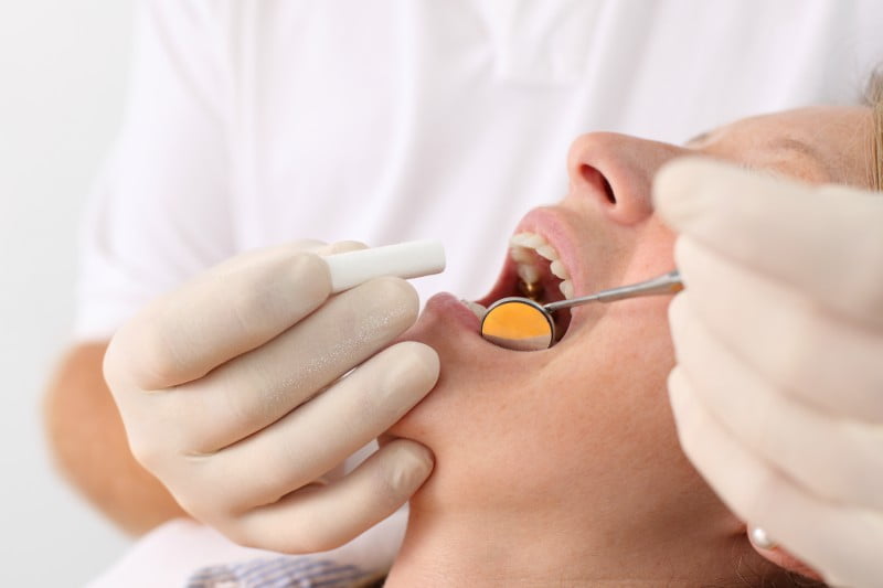 Abordagem multidisciplinar pode reduzir incidência de cáries dentárias