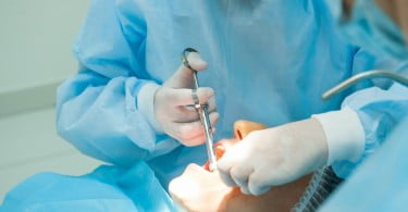 Mercado de tratamentos de cancro oral vai crescer, prevê estudo