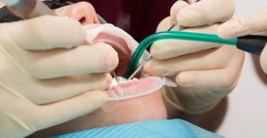 Saúde oral e doenças não transmissíveis: Mundo a Sorrir debate fatores de risco