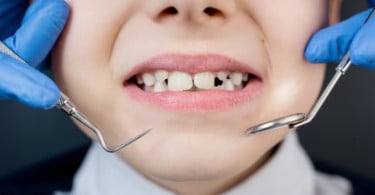 criança no dentista Saúde Oral