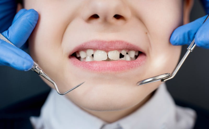 criança no dentista Saúde Oral