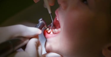 Odontofobia - como afeta a sua clínica e como a tratar?
