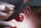 FDI diz que doença periodontal deve ser prioridade nas políticas mundiais