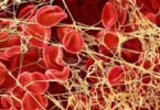Fabrício Vieira sobre utilização de fibrina: “A cada dia que passa surgem novas aplicabilidades para este biomaterial autólogo”