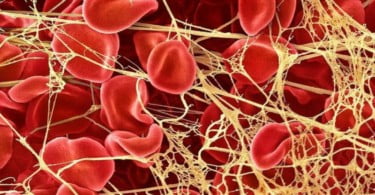 Fabrício Vieira sobre utilização de fibrina: “A cada dia que passa surgem novas aplicabilidades para este biomaterial autólogo”