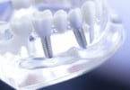 Congresso dos Técnicos de Prótese Dentária já tem programa