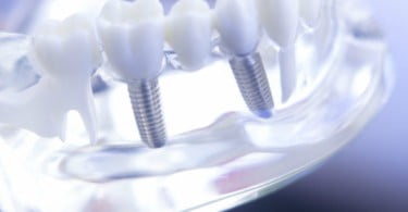 Congresso dos Técnicos de Prótese Dentária já tem programa