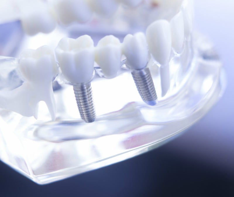 Congresso dos Técnicos de Prótese Dentária já tem programa