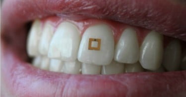 Cientistas desenvolvem sensor que analisa alimentos ingeridos