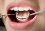 check up de saúde oral Saúde Oral