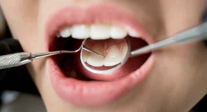 check up de saúde oral Saúde Oral