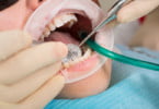 Dentistas britânicos tratam refugiados sírios e libaneses