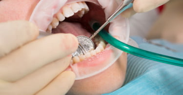 Dentistas britânicos tratam refugiados sírios e libaneses
