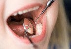 Consulta de medicina dentária no primeiro ano de vida “não é menos importante que a consulta no pediatra”