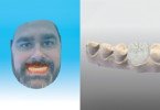 Software de dentisteria digital Dental Wings tem novas atualizações
