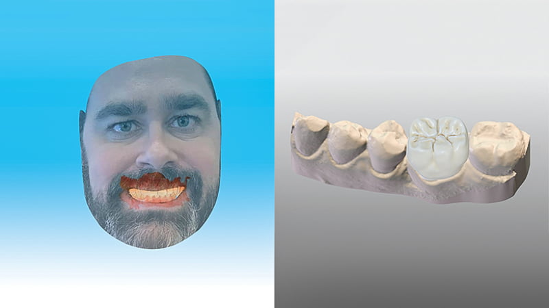 Software de dentisteria digital Dental Wings tem novas atualizações
