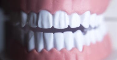 Doença periodontal e doença coronária partilham a mesma base genética
