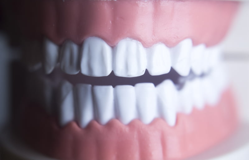 Doença periodontal e doença coronária partilham a mesma base genética