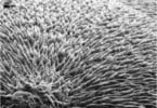 Investigadores desenvolvem material capaz de regenerar esmalte dentário