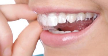 Marca britânica de aparelhos ortodônticos invisíveis procura distribuidores em Portugal