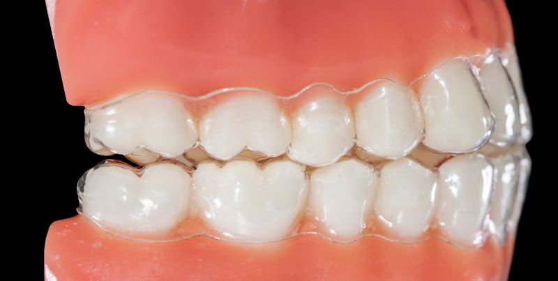 bruxismo Saúde Oral