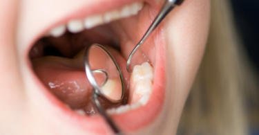 Quase dez anos depois do lançamento do programa dos cheques-dentista para as crianças de sete, dez e 13 anos das escolas públicas, ainda existem muitos beneficiários que não utilizam estes vales