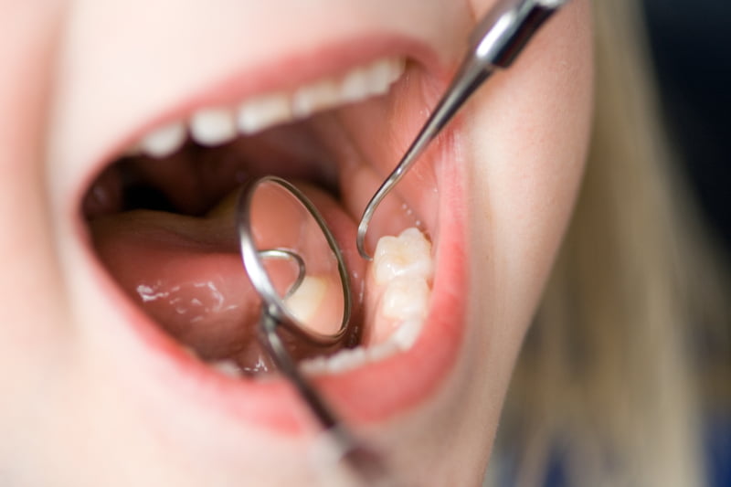 Quase dez anos depois do lançamento do programa dos cheques-dentista para as crianças de sete, dez e 13 anos das escolas públicas, ainda existem muitos beneficiários que não utilizam estes vales