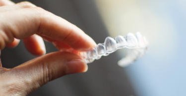 Ortodontistas preocupados com a popularidade de aparelhos ortodônticos transparentes ‘caseiros’