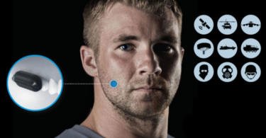 Molar Mic: e se um ‘implante dentário’ permitisse atender chamadas telefónicas?