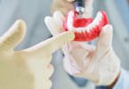 Reveladas novas diretrizes para limpeza e manutenção de próteses dentárias
