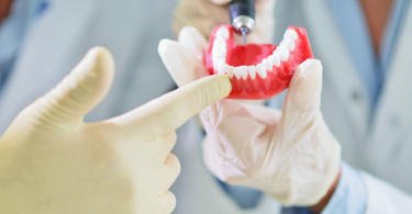 Reveladas novas diretrizes para limpeza e manutenção de próteses dentárias
