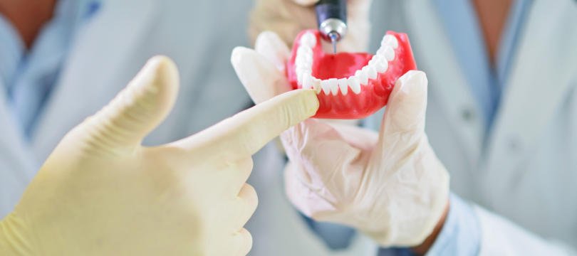 Reveladas novas diretrizes para limpeza e manutenção de próteses dentárias