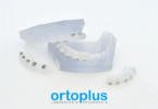 Ortoplus lança novo catálogo de Ortodontia Digital