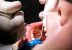 check up oral saúde oral